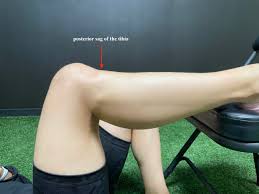 Image result for PCL Sag Test