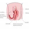 Die beschwerden sind an der vulva im bereich der inneren schamlippen um die harnröhre herum bis zur klitoris. Https Encrypted Tbn0 Gstatic Com Images Q Tbn And9gctc 2bq 9xkzgbb9wwgout1vdulna856jrflbu8taszgo7a59tj Usqp Cau