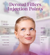 Image result for Dermal Filler Injection