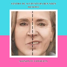 Centro de Acupuntura Ben Shen