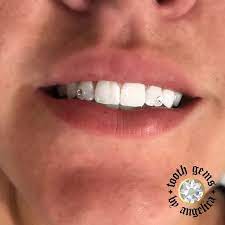 Tooth Gems By Angelica Tooth Gem Diamond Teeth Teeth Jewelry