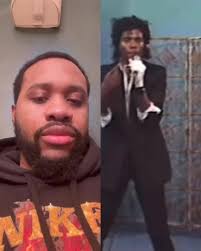 Michael Jackson Moles When I Was 5 Talent Show