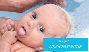 Namun ada hal lain yang menyebabkan bercak putih muncul di mulut bayi, yaitu infeksi jamur. Lidah Putih Pada Bayi Akibat Susu Atau Infeksi Jamur Ini Bedanya Medisweb