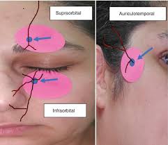 Image result for Forehead Regional Block