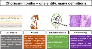 Image result for Chorioamnionitis
