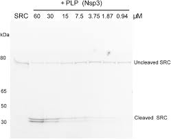 See more of ooi teik seng bicycle shop on facebook. Characterisation Of Protease Activity During Sars Cov 2 Infection Identifies Novel Viral Cleavage Sites And Cellular Targets For Drug Repurposing Biorxiv