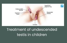 Image result for Undescended Testicle