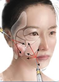 Pin Em Plastic Surgery News