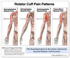 Pin On Body Pain