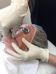 7 Answers To Your Dermaplaning Questions Skincare Physicians
