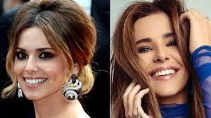 Cheryl Cole Teeth: Before and After
