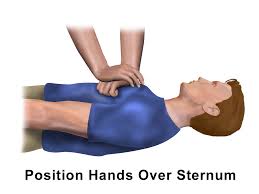 Image result for Chest Compressions