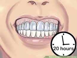 It has been said that you're never fully dressed without a smile and it is true that a great smile can be your best accessory. How To Straighten Teeth Without Braces At Home In Hindi Teethwalls