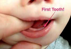 Age 7 Months Old My Chris S First Baby Tooth First Tooth Teeth Baby Teeth