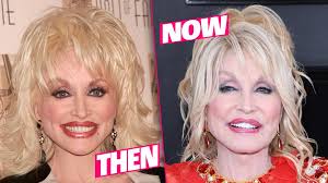 Usually, men do not really concern about their looks, so they do not get plastic surgery issue very often. Dolly Parton S Plastic Face Fiasco Revealed In Shocking New Photos
