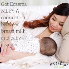 Every case is different since the paths and factors that lead to acute through a full evaluation of the breastfeeding mother's own health such as their past medical history, food allergies, digestive and immune health. What You Need To Know About Breast Milk And Eczema
