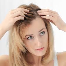 Une perte de cheveux subite. Perte De Cheveux Feminine