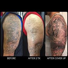 Henna brow tinting results can last up to 2 weeks on skin and 4 weeks on hair. Laser Tattoo Removal Ageless Medical Premier Medspa Serving Weston Pembroke Pines And Davie