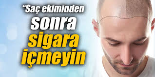 Sac Ekiminden Sonra Sigara Icmeyin