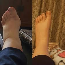 Maybe you would like to learn more about one of these? These Cheap Compression Socks Really Work