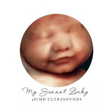 My Sweet Baby HD Ultrasounds