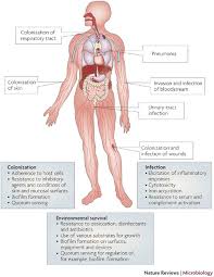 Image result for Striga baumannii