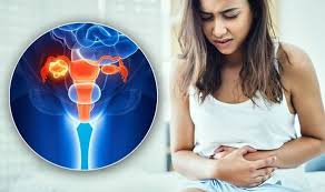 Schilder, common ovarian cancer symptoms include abdominal distention (also known as expansion) and a pelvic mass or discomfort, which is a. Ovarian Cancer Symptoms Signs Of A Tumour Include Stomach Bloating And Urine Problems Express Co Uk