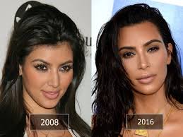 At first, kylie dodged questions about her burgeoning pucker, saying it was all down to the way she … Before After Photos Kim Kardashian Plastic Surgery Plastic Surgery Home Decor