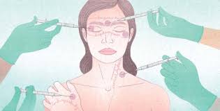 Image result for Botulinum Toxin Injection