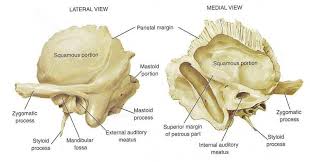 Image result for Temporal Bone