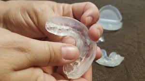 How to mold a mouthguard for grinding. Moldable Mouth Guard For Grinding Teeth Youtube