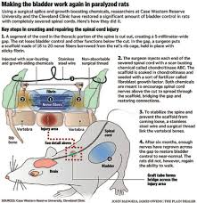 I use it for both living and working. Cleveland Researchers Restore Bladder Control In Rats With Spinal Cord Injuries News Spinal Cord Injury Zone