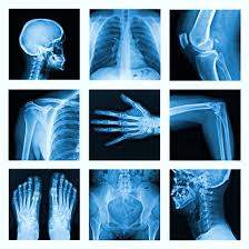 Radiation In Medicine X Rays
