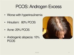 Polycystic Ovary Syndrome Pcos Online Presentation