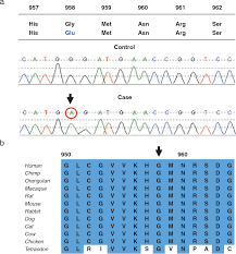 Figure 3 From A Novel Mutation In Med 12 Causes Fg Syndrome Opitz Kaveggia Syndrome Semantic Scholar