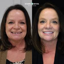 Stubbs Dental Implant Center