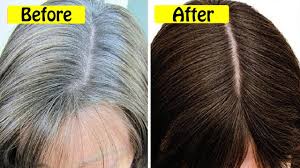 But the reason behind premature grey hair they impart natural colour to your hair. 60 Years Old White Hair Cured In 1 Day Turn White Hair Into Black Solution Youtube