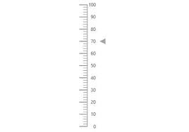 Javascript Linear Gauge Chart Html5 Linear Gauge Syncfusion