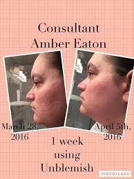 Skincare solutions for acne and aging issues