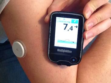 Continuous Glucose Monitoring, AI generated