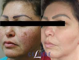 Kevin DiCerbo, RN, BSN