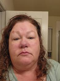 What product is best for redness