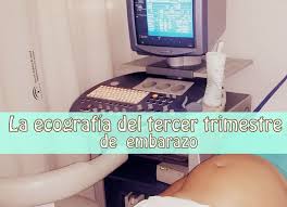 33 semanas de embarazo ecografía. Semanas 32 Y 33 De Embarazo Y La Ecografia Del Tercer Trimestre La Aventura De Mi Embarazo