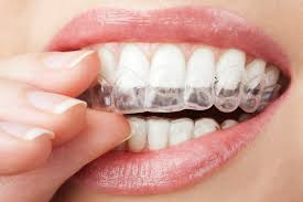 How to use invisalign cleaning crystals. Elm Grove Invisalign Honest Teeth Honest Teeth Dentistry