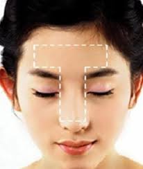 티존,유존 이란?］티존 유존 이란 무엇인가 : 네이버 블로그