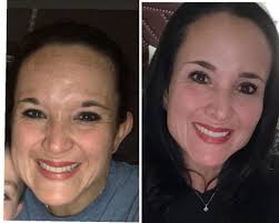 You are NEVER too old to change your skin or start something new!🙌 Mitzi  looks YEARS younger, and is loving aging backwards!! ❤ ⏰