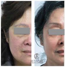 Restore Cosmetic and Skin Surgery