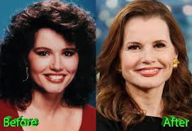 It's been 30 years since 'thelma & louise' was released, and geena davis now campaigns for equal representation of women in media. Geena Davis Plastic Surgery The Truth