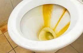 Get a bottle of distilled white vinegar from the local market or an online. How To Remove Yellow Stains From Toilet Bowl Seat Toiletseek