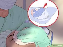 Jadi apa yang harus kita lakuan? Cara Menangani Plasenta Previa Dengan Gambar Wikihow